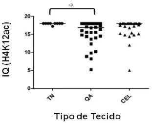 Gráfico  10  –  Distribuição  dos  casos  de  tecido  (lábio)  normal  (TN),  queiliteactínica  (QA)  e  carcinoma  epidermóide  de  lábio  (CEL)  segundo  índice  de  quickscore  (IQ)  de  reatividade  imunoistoquímica  para  H4K12ac