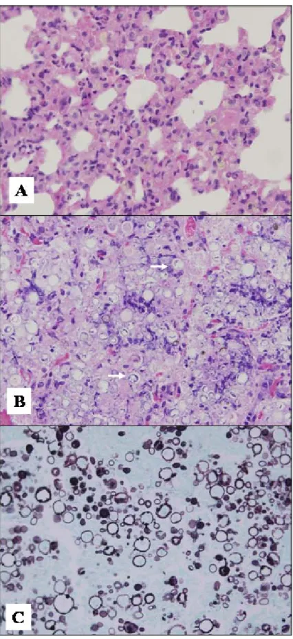 Figura 1. Secção histológica do pulmão de C. callosus inoculado com 0,6 x 10 5  leveduras de P