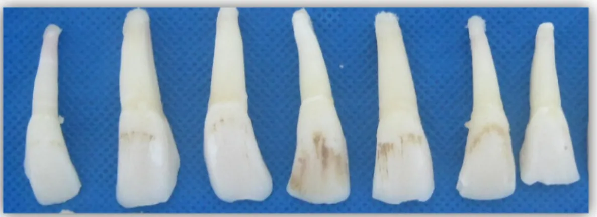 Figura  1.  Seleção  dos  dentes  para  padronização  de  acordo  com  os  critérios  estabelecidos