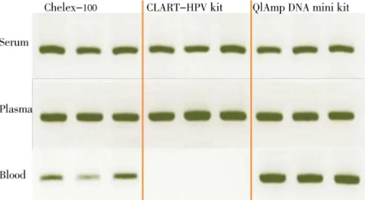 Figure 1.  PCR  lip L 32  results in spiked samples using different  DNA extraction methods