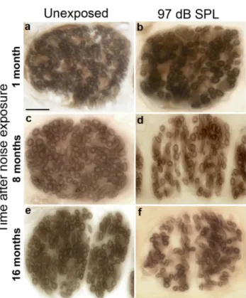 Fig 6. Cochlear-nerve peripheral axons can be counted in tangential sections through the osseous spiral lamina