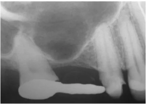 Figura 1. Radiografia Panorâmica 