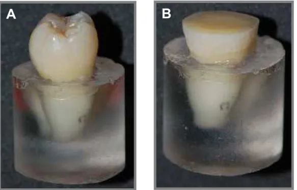 Figura 2. Sequência inicial do preparo das amostras. A- dente hígido fixado em  um bloco de resina de poliestireno, B- dente com dentina superficial exposta
