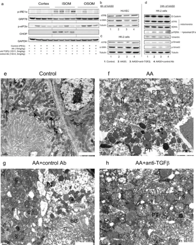 Fig 9. Anti-transforming growth factor beta (TGFβ) Ab decreased aristolochic acid (AA)-induced reticulum endoplasmic (ER) and mitochondrial (MT) stress protein expression in kidney tissue