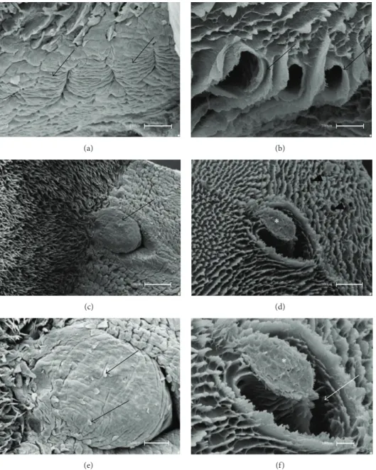 Figure 2: Scanning electron micrographs—foliate and vallate papillae of rats. (a) he foliate papillae are constituted by epithelial folds (arrows) and separated by parallel grooves