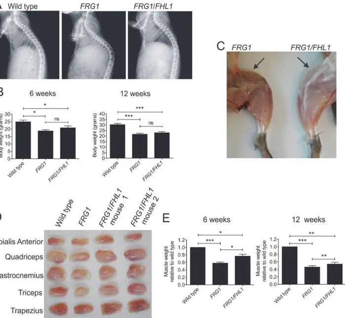 Fig 3. FHL1 reduces muscle wasting in dystrophic FRG1 mice. (A) Representative X-ray images of the spine of mice from the indicated genotypes