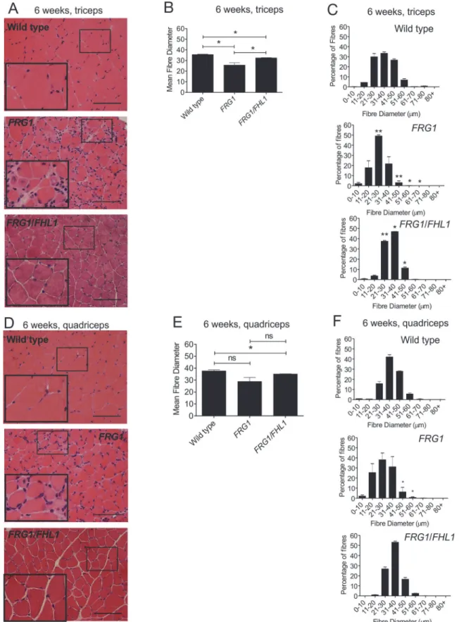 Fig 4. FHL1 improves muscle pathology in dystrophic FRG1 mice. Representative images of transverse muscle sections from the triceps (A) or quadriceps (D) muscles of 6-week-old wild type, FRG1 and FRG1/FHL1 mice stained with H&amp;E