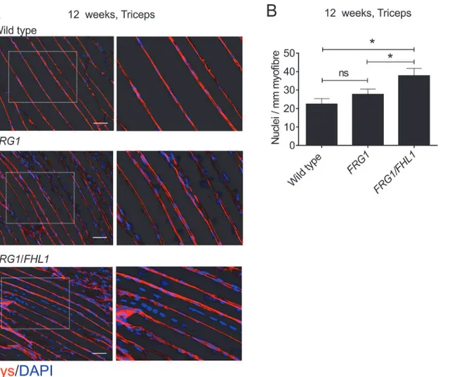 Fig 8. FHL1 enhances myoblast fusion in FRG1 mice. (A) Representative images of longitudinal sections of triceps muscle from 12-week old wild type, FRG1 and FRG1/FHL1 mice co-stained for dystrophin to outline the muscle fiber membrane and DAPI to detect nu