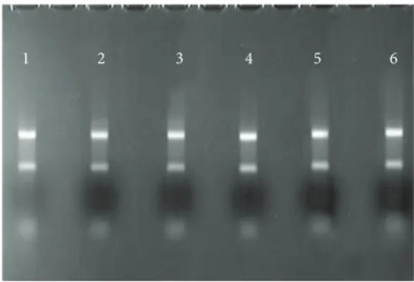 Figure 1: Total RNA from primary culture of breast tumor for different postsurgery treatment periods on a 1% agarose gel (1 : 8 h;