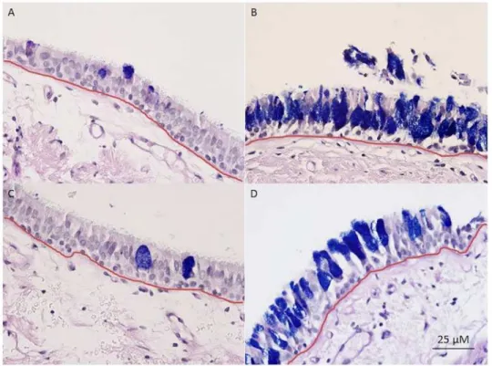 Fig 1. Examples of mucosal biopsies from A) a healthy nonsmoker, B) a healthy smoker, C) a COPD subject without chronic bronchitis, and D) a COPD subject with chronic bronchitis, taken at 40x.