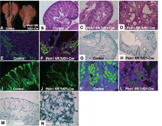 Figure S1 Ptch1 fl/fl ;Tcf21-Cre and Ctnnb1 ex3/+ ;Tcf21-Cre mice show strikingly similar sarcomas