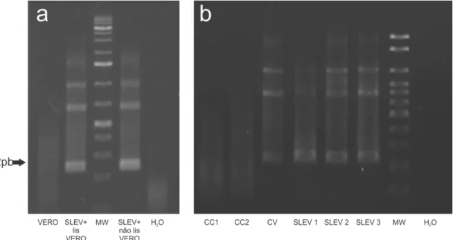 Figura  6:  Fragmento  genômico  amplificado  de  vírus  da  encefalite  de  Saint  Louis  (232pb)  em  amostra  de  linhagem celular VERO (A) e astrócitos (B)