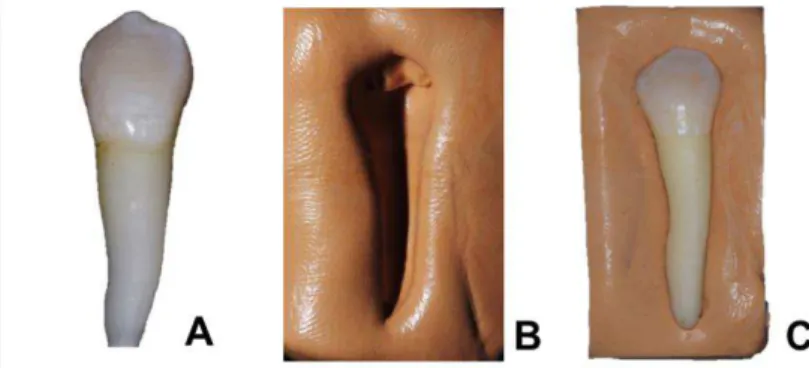 Figura  10.  Geração  da  matriz:  A.  Espécime  hígida;  Matriz  de  silicone  obtida  após moldagem da superfície lingual do espécime, com silicone por adição; B