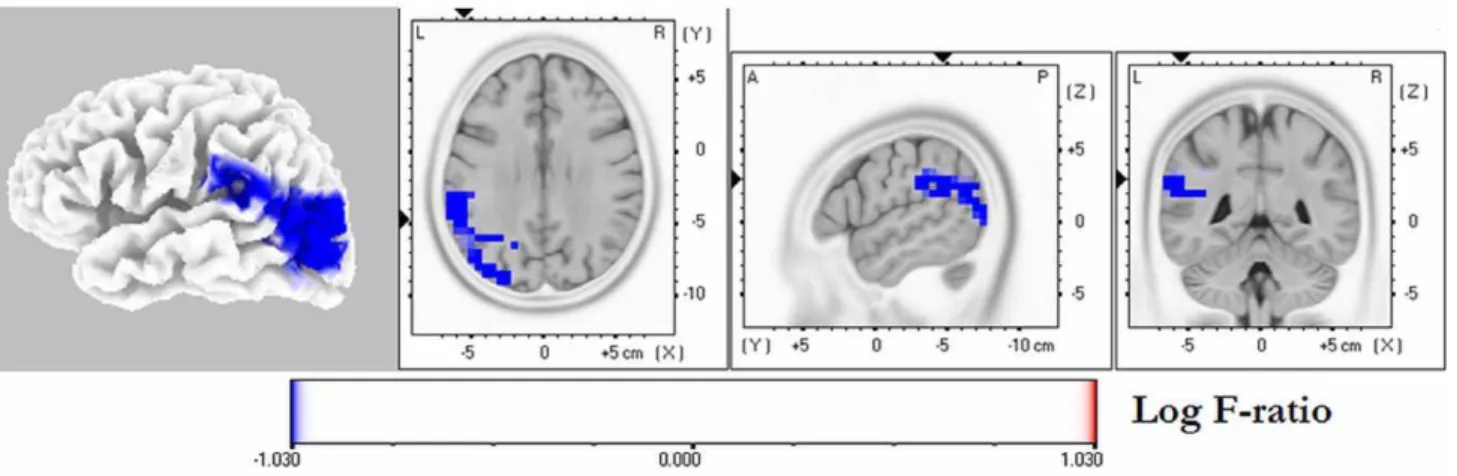 Figure 4. eLORETA wire diagram illustrating cortical areas with significantly decreased (blue wires; threshold: t = 23.49, p,0.05 corrected) and increased (red wires; threshold: t = 4.26, p,0.05 corrected) alpha2 and theta lagged phase synchronization, res