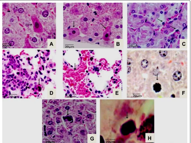 Fig. 1 Histological lesions in BALB/c infected with L. interrogans serovar Icterohaemorrhage