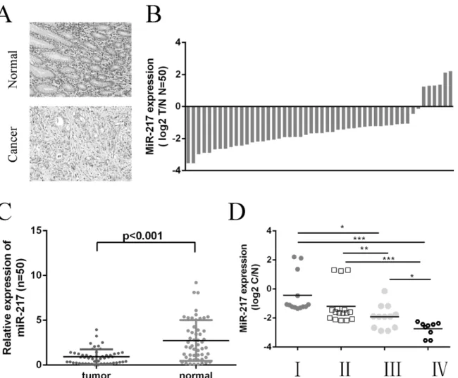 Fig 2. MiR-217 is downregulated in GC tissues. (A) The tissues were histological confirmed using H&amp;E staining