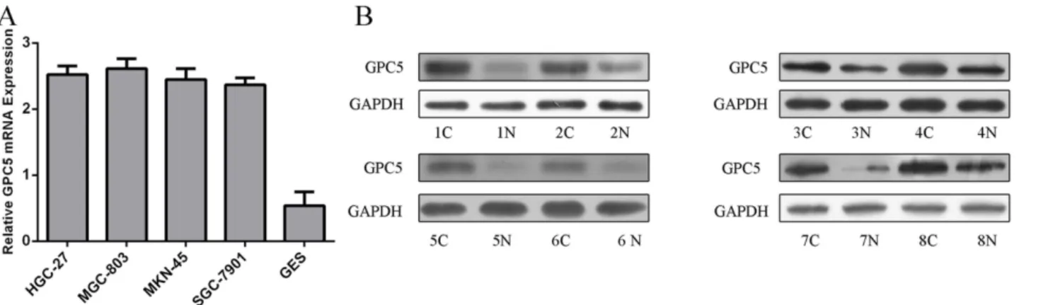 Fig 6. GPC5 is upregulated in GC cell lines and specimens. (A) The mRNA expression of CPG5 was assessing in GC cell lines (SGC-7901, HGC-27, MGC-803, MKN-45) and GES-1 using Quantitative RT–PCR