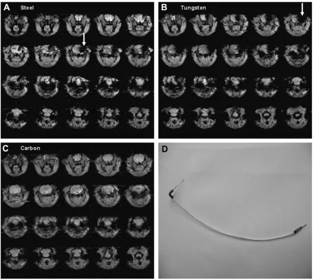 Fig. 5 depicts a voxel by voxel analysis of PTZ infused rats comparing PTZ-P (periodic stimulation) against PTZ-NP  (non-periodic stimulation) in panel A, and PTZ-NP against PTZ-P in panel B