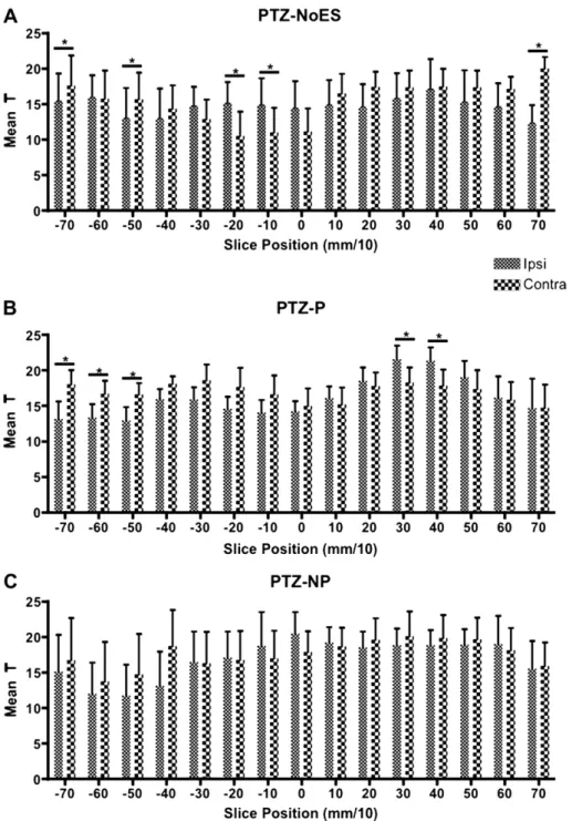 Fig. 4. In order to quantify lateralization of brain recruitment during seizure, the mean value of T for each hemisphere, from parametric maps of all recorded animals, was calculated for each anterioreposterior slice ( 70 to þ 70  0.1 mm)