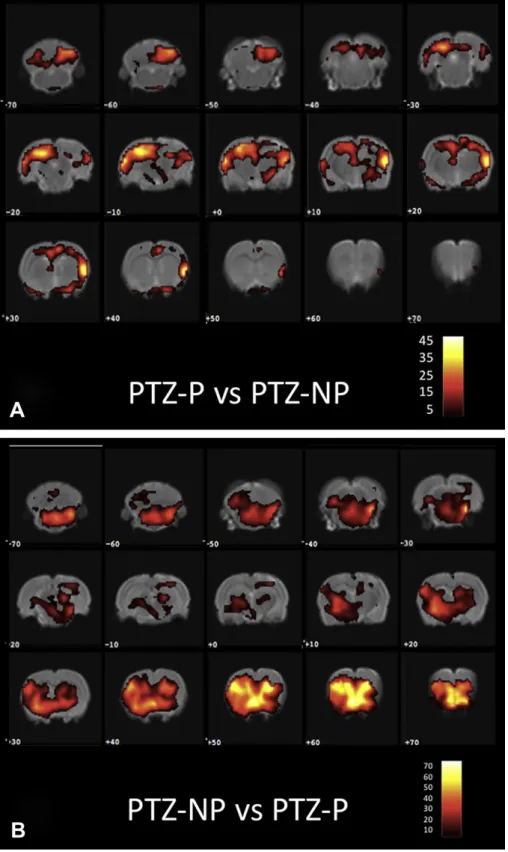 Fig. 5. Group statistical parametric maps of PTZ infused rats comparing PTZ-P (periodic stimulation) against PTZ-NP (non-periodic stimulation) in panel A, and PTZ-NP against PTZ- PTZ-P in panel B