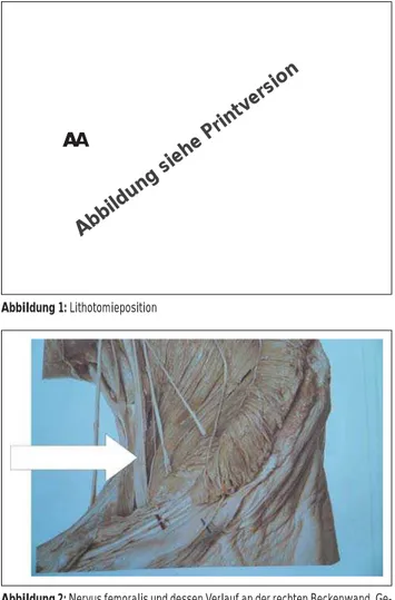 Abbildung 1: Lithotomieposition