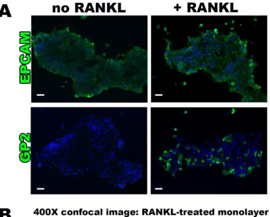 Fig 2. RANKL induces M cell surface marker presence and typical morphology. (A) Epifluorescense imaging (100X magnification) of human intestinal monolayers showing uniform expression of epithelial cell surface marker EPCAM in no RANKL and RANKL-treated mon