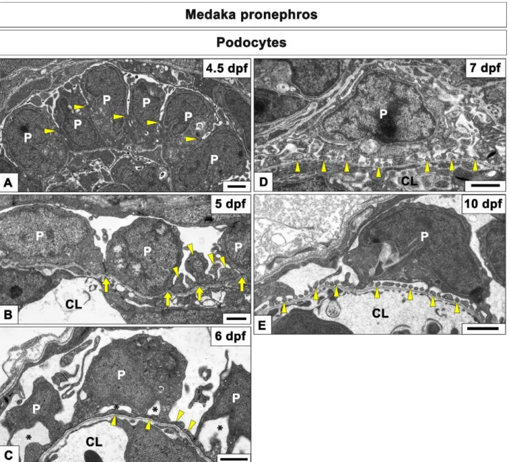 Figure 5. Transmission electron microscopy of podocytes development in medaka pronephric glomerulus