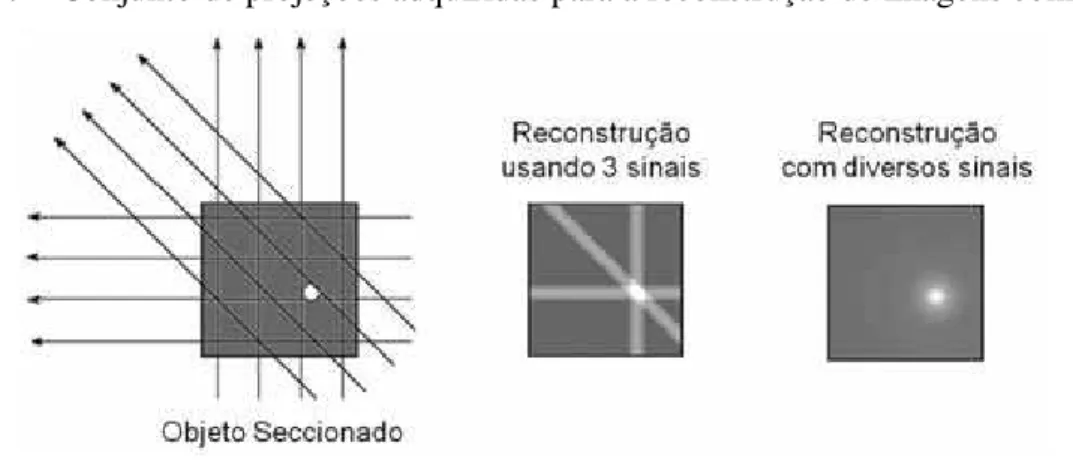 Figura 7 – Conjunto de projeções adquiridas para a reconstrução de imagens com a CT. 