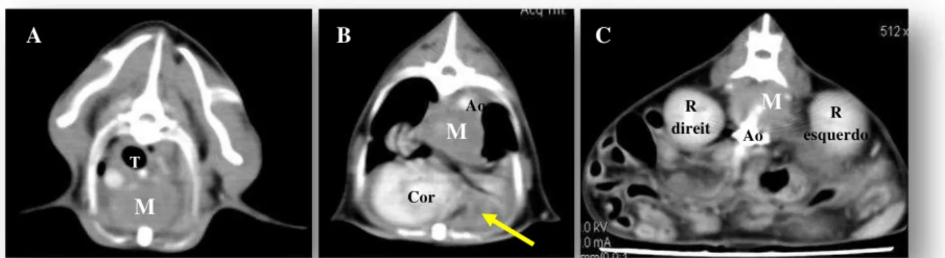 Figura 2: Imagens  tomográfica em fase pós contraste endovenoso, eixo transversal, na altura de T2 (A), T8 (B)  e abdome cranial (C), demonstrando a extensão da massa mediastinal (M), área de consolidação pulmonar (seta)  e  relação  com  estruturas  adjac