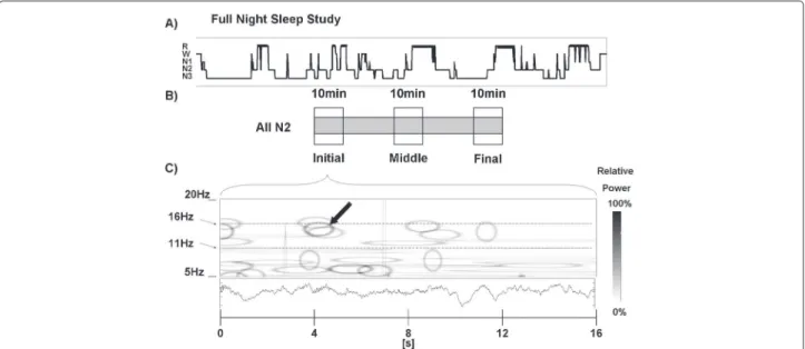 Figure 1 Procedure employed for the automatic spindle detection. A) Hypnogram representing one full-night recording (EEG time series), which was segmented into 2048 digital point-juxtaposed bins and subjected to matching pursuit signal decomposition