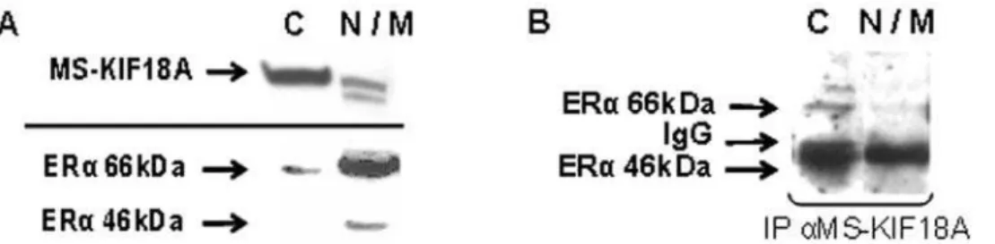 Figure 4. Interaction between NF-kB and MS-KIF18A or ERa. IP with anti-p50 (1) with anti-p65 (2) WB performed with anti-MS-KIF18A (A) with anti-ERa (B)