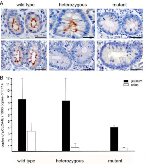 Fig 4. The CLCA4b protein is exclusively located in apical membranes of intestinal crypt epithelial cells and shows high variations in response to the genomic deletion of CLCA4b