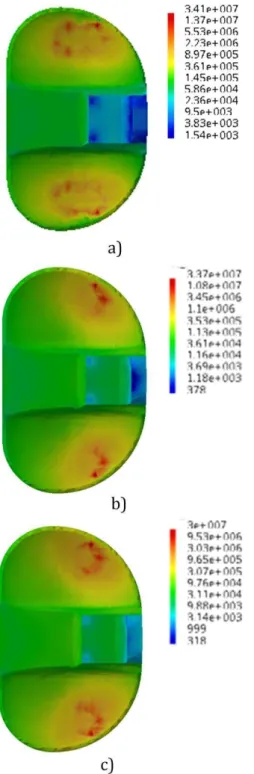 Fig. 4. Von Misses Stress for flexion of: a) 15°, b) 45°,  and c) 60° [2]. 