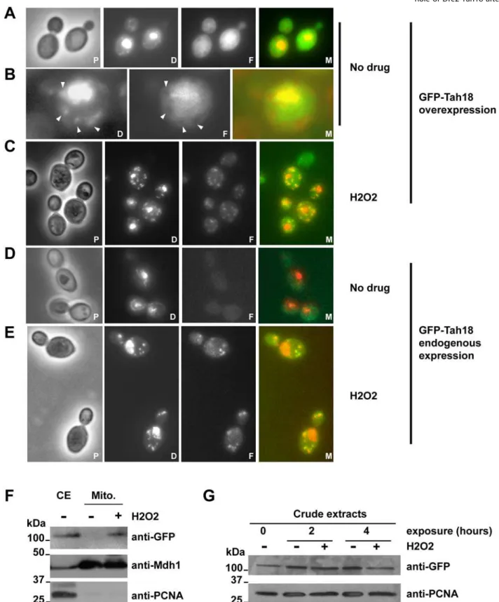 Figure 2. GFP-Tah18 relocalizes to the mitochondria after H 2 O 2 exposure. A–E: Fluorescence microscopy of live cells expressing GFP-Tah18 under the control of the Gal promoter in an exponential culture in YPGal (strain 10H8, panels A–C) or under the cont