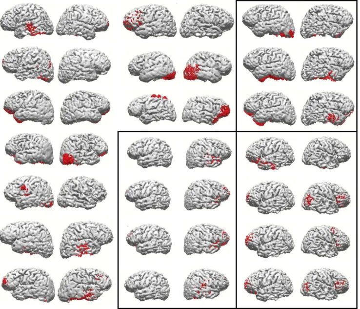 Figure 4. Representation of source reconstruction results (as in figure 3), of the reasoning task components from all subjects, that were not satisfactorily explained by the attention task