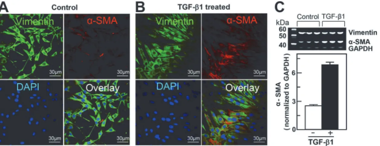 Fig 2. TGF-β1-mediated differentiation of NIH/3T3 fibroblasts into myofibroblasts. A and B, Representative fluorescent images of naive (control) and differentiated (TGF-β1-treated) cells