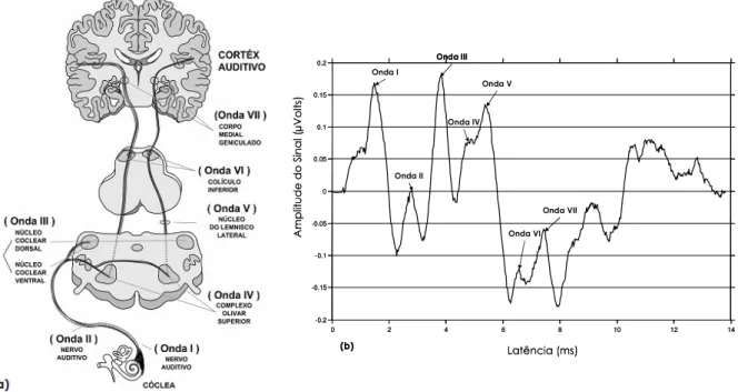 FIGURA  3  -  As  principais  ondas  dos  PEATE   e  suas  correlações  anatômicas.  (a)  Estruturas  anatômicas