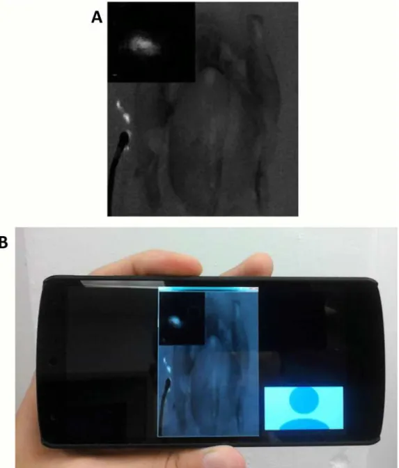 Fig 6. Telemedicine enabled by the Integrated Imaging Goggle. (A) The fluorescence video stream as seen through the remote goggle, transmitted via 4G LTE network