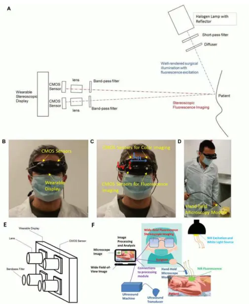 Fig 1. Prototype Integrated Imaging Goggles. (A) Schematic of 2-sensor setup. (B) Photo of 2-sensor setup for stereoscopic fluorescence imaging
