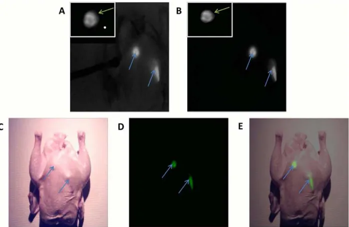 Fig 3. Image-guided surgeries aided by the Integrated Imaging Goggles. Intraoperative imaging using the 2-sensor setup (A) with the addition of unfiltered NIR light for the imaging of anatomical data, and (B) without unfiltered NIR light