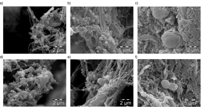Fig. 1. Scanning electron micrographs of bacteria in vascular biopsies from patients with periodontitis