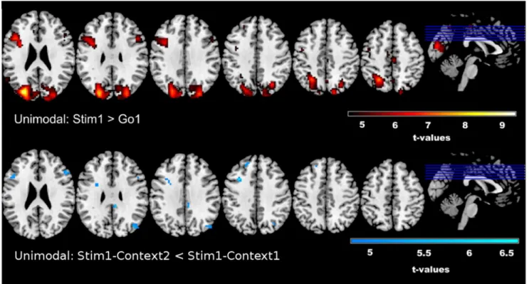 Figure 4. Unimodal fMRI Results. Results from the unimodal fMRI analysis reveal increased activity in the rIFG and left MFG during response inhibition (Stim1