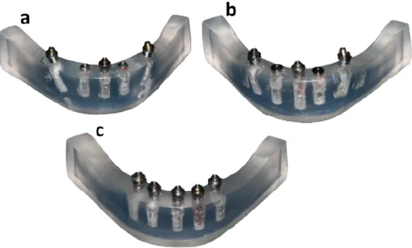 Figura 2. Modelos mestre com 5 implantes diferenciados pela inclinação do  implante distal, A- implantes distais inclinados 30 graus; B- 5 implantes distais  inclinados 17 graus; C- modelo mestre com  implantes verticais