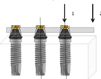 Figura 10. Desenho representativo dos carregamentos: 1- carregamento no  implante distal; 2- carregamento ao final do cantilever