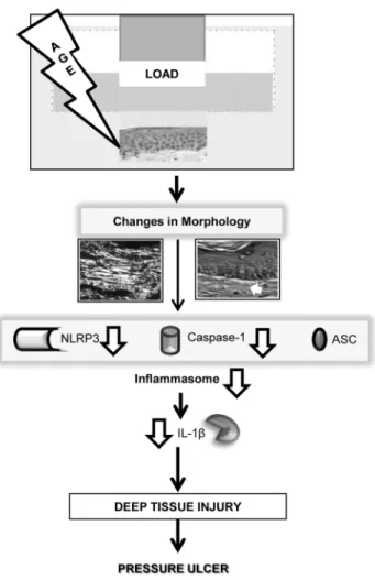 Figure 4. Diagram summarizes effects of load and aging in development of deep tissue injury and pressure ulcers.