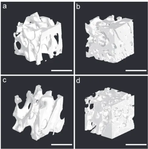 Fig 4. Segmented 3D tomographic reconstruction images of newly formed trabecular bone in the region of interest
