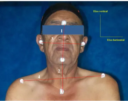 Figura 3.8: Segmentos do plano frontal anterior 