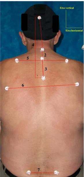 Figura 3.9: Segmentos do plano frontal posterior. 