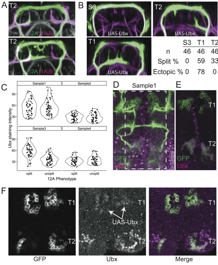 Fig 6. 12A in T2 is a variability “hot-spot.” (A) Two examples of transverse projections through the T2 neuromere showing the neurite bundles of hemilineages 11A and 11B (magenta) relative to those of 12A (green)