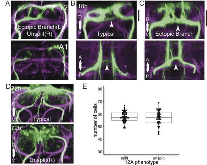 Fig 3. Developmental variability in hemilineage 12A. (A) Transverse optical sections showing examples of variation in T2 and A1.